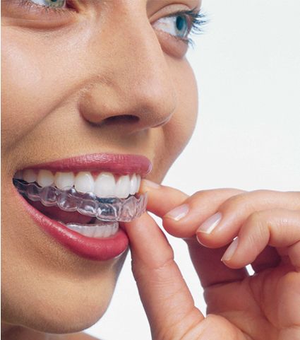 Invisalign Dentist Parramatta